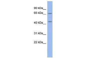 MIER3 antibody used at 0. (MIER3 Antikörper  (Middle Region))