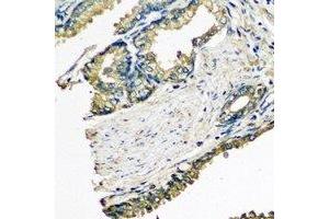 Immunohistochemical analysis of ETFA staining in human prostate formalin fixed paraffin embedded tissue section. (ETFA Antikörper)
