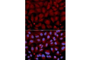 Immunofluorescence analysis of U2OS cells using BCHE antibody (ABIN5970682). (Butyrylcholinesterase Antikörper)