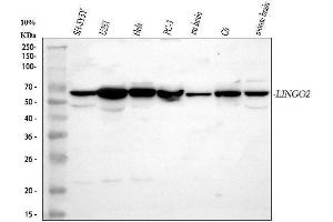 Western blot analysis of LINGO2 using anti-LINGO2 antibody (ABIN7601082).