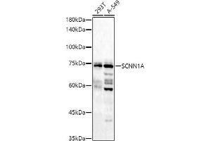 Western blot analysis of extracts of various cell lines, using (ABIN6129465, ABIN6147447, ABIN6147448 and ABIN6221186) at 1:1000 dilution. (SCNN1A Antikörper  (AA 105-225))