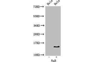 Western Blot Positive WB detected in: Hela cell acid extracts treated by NaB All lanes: HIST1H2BB antibody at 2 μg/mL Secondary Goat polyclonal to rabbit IgG at 1/50000 dilution Predicted band size: 14 kDa Observed band size: 14 kDa (HIST1H2BB Antikörper  (acLys16))