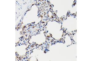 Immunohistochemistry of paraffin-embedded rat lung using SFTP Rabbit pAb (ABIN3017436, ABIN3017437, ABIN3017438 and ABIN6220091) at dilution of 1:50 (40x lens). (Surfactant Protein A1 Antikörper)
