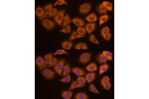 Immunofluorescence analysis of PC-3 cells using N Rabbit mAb (ABIN7268773) at dilution of 1:200 (40x lens). (NAT1 Antikörper)
