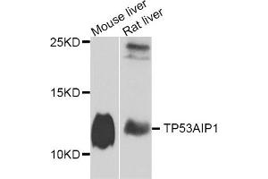 Western blot analysis of extracts of mouse liver and rat liver cell lines, using TP53AIP1 antibody. (TP53AIP1 Antikörper)
