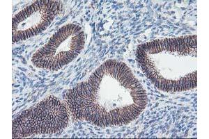 Image no. 7 for anti-Arachidonate 15-Lipoxygenase (ALOX15) antibody (ABIN1496359)