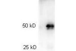 Western Blotting (WB) image for Goat anti-Rabbit IgG (Heavy & Light Chain) antibody (HRP) (ABIN964977) (Ziege anti-Kaninchen IgG (Heavy & Light Chain) Antikörper (HRP))