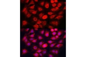 Immunofluorescence analysis of C6 cells using C Rabbit pAb (ABIN7266110) at dilution of 1:50 (40x lens). (Caspase 1 Antikörper)