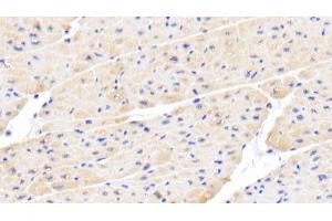 Detection of IL18 in Porcine Cardiac Muscle Tissue using Polyclonal Antibody to Interleukin 18 (IL18) (IL-18 Antikörper  (AA 36-192))