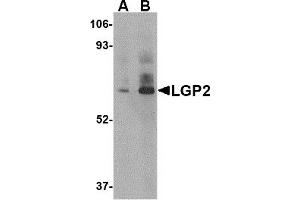 Western Blotting (WB) image for anti-DEXH (Asp-Glu-X-His) Box Polypeptide 58 (DHX58) (C-Term) antibody (ABIN1030481) (DHX58 Antikörper  (C-Term))