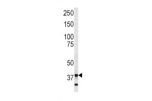 Western blot analysis of Annexin V antibody (C-term) (ABIN390502 and ABIN2840858) in SK-Br-3 cell line lysates (35 μg/lane). (Annexin V Antikörper  (C-Term))