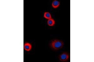 Immunofluorescent analysis of IGF1 Receptor (pY1161) staining in HeLa cells. (IGF1R Antikörper  (C-Term, pTyr1161))
