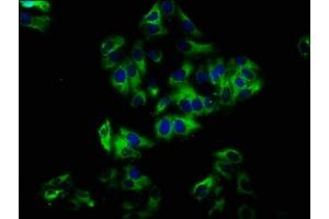 Immunofluorescence staining of HepG2 cells with ABIN7161004 at 1:33, counter-stained with DAPI. (NOX1 Antikörper  (AA 418-564))