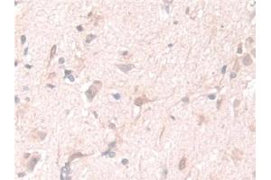 Detection of PGM1 in Human Cerebrum Tissue using Polyclonal Antibody to Phosphoglucomutase 1 (PGM1) (Phosphoglucomutase 1 Antikörper  (AA 1-235))