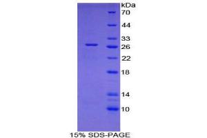 SDS-PAGE (SDS) image for WNT1 Inducible Signaling Pathway Protein 2 (WISP2) (AA 15-250) protein (His tag,GST tag) (ABIN2122340) (WISP2 Protein (AA 15-250) (His tag,GST tag))