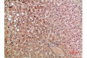Immunohistochemical analysis of paraffin-embedded human-liver, antibody was diluted at 1:200 (CCR5 Antikörper  (AA 151-200))