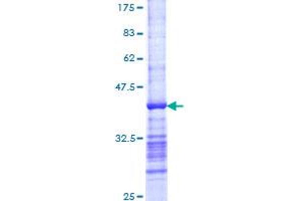 Cbl Proto-Oncogene B, E3 Ubiquitin Protein Ligase (CBLB) (AA 21-129) protein (GST tag)