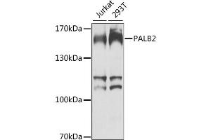 Western blot analysis of extracts of various cell lines, using PALB2 antibody. (PALB2 Antikörper)