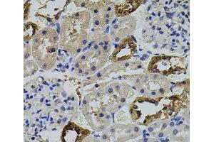 Immunohistochemistry of paraffin-embedded Rat kidney using AURKC Polyclonal Antibody (Aurora Kinase C Antikörper)