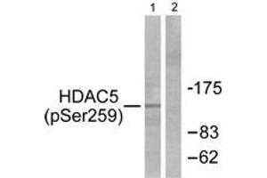 Western blot analysis of extracts from HepG2 cells, using HDAC5 (Phospho-Ser259) Antibody. (HDAC5 Antikörper  (pSer259))