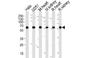 Western blot analysis of lysates from Hela,  cell line, mouse heart and kidney, rat heart and kidney tissue (from left to right), using PHB Antibody (ABIN1882046 and ABIN2838486). (BBS4 Antikörper  (AA 1-240))