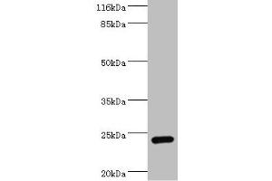 Western blot All lanes: STXBP6 antibody at 2 μg/mL + Mouse brain tissue Secondary Goat polyclonal to rabbit at 1/10000 dilution Predicted band size: 24, 12 kDa Observed band size: 24 kDa (STXBP6 Antikörper  (AA 2-210))