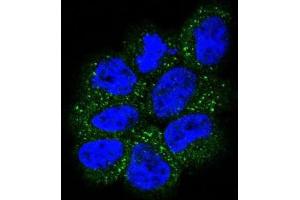 Immunofluorescence (IF) image for anti-GTPase NRas (NRAS) antibody (ABIN5023677) (GTPase NRas Antikörper)