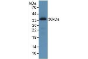 Detection of Recombinant ROS1, Human using Monoclonal Antibody to C-Ros Oncogene 1, Receptor Tyrosine Kinase (ROS1) (ROS1 Antikörper  (AA 1945-2222))
