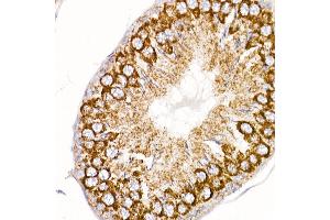 Immunohistochemistry (IHC) image for anti-Mitochondrially Encoded NADH Dehydrogenase 4 (MT-ND4) antibody (ABIN7268602)
