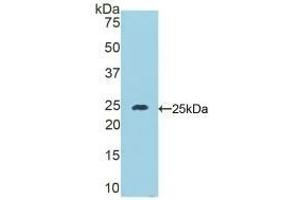 Detection of Recombinant DSC1, Mouse using Polyclonal Antibody to Desmocollin 1 (DSC1) (Desmocollin 1 Antikörper  (AA 135-340))