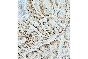 IHC analysis of MCM2 using anti-MCM2 antibody (ABIN7601593).