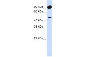 Adducin beta 2 antibody used at 1 ug/ml to detect target protein. (Adducin beta 2 Antikörper)