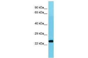 Host: Rabbit Target Name: MRPS26 Sample Type: Jurkat Whole Cell lysates Antibody Dilution: 1. (MRPS26 Antikörper  (C-Term))
