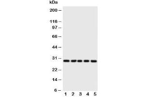 Western blot testing of 14-3-3 sigma antibody and Lane 1:  HeLa;  2: A549;  3: A549;  4: COLO320;  5: SE620 cell lysate (14-3-3 sigma/SFN Antikörper  (AA 140-156))