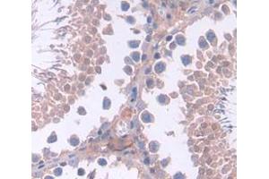 IHC-P analysis of Mouse Tissue, with DAB staining. (SHBG Antikörper  (AA 219-358))