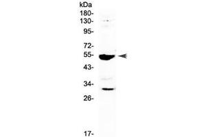 Western blot testing of rat RH35 cell lysate with Mmp13 antibody at 0. (MMP13 Antikörper)
