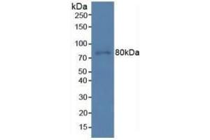 Detection of PDCD6IP in Human Hela Cells using Polyclonal Antibody to Programmed Cell Death Protein 6 Interacting Protein (PDCD6IP)