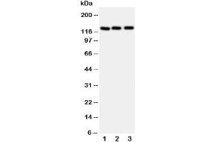 Western blot testing of Myosin Phosphatase antibody and Lane 1:  rat liver;  2: human 293T;  3: (h) HeLa cell lysate. (Myosin Binding Subunit Antikörper  (N-Term))