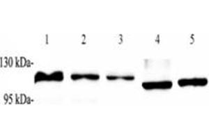 Western blot analysis of ZSCAN20 (ABIN7076252) at dilution of 1: 1000,Lane 1: Raji cell lysate,Lane 2: K562 cell lysate,Lane 3: HEK293 cell lysate,Lane 4: Mouse heart tissue lysate,Lane 5: Rat heart tissue lysate (ZSCAN20 Antikörper)