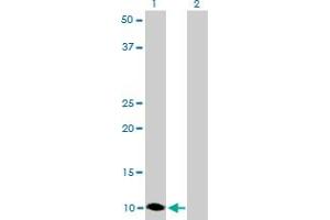 Western Blot analysis of S100A6 expression in transfected 293T cell line by S100A6 monoclonal antibody (M16), clone 6D1.