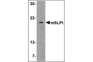 Western blot analysis of SLPI in A-20 cell lysate with this product at 2 μg/ml.