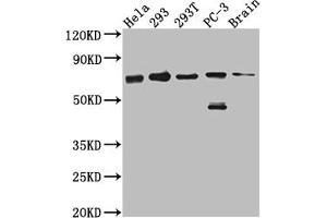 Western Blot Positive WB detected in: Hela whole cell lysate, 293 whole cell lysate, 293T whole cell lysate, PC-3 whole cell lysate, Mouse Brain whole cell lysate All lanes: LTA4H antibody at 1:1000 Secondary Goat polyclonal to rabbit IgG at 1/50000 dilution Predicted band size: 70, 60, 58, 67 kDa Observed band size: 70 kDa (Rekombinanter LTA4H Antikörper)