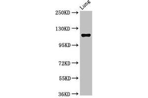 Western Blot Positive WB detected in: Rat lung tissue All lanes: MAP3K9 antibody at 2. (MAP3K9 Antikörper  (AA 864-1098))