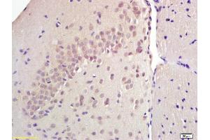 Formalin-fixed and paraffin embedded rat brain labeled with Anti SREBP-1 Polyclonal Antibody, Unconjugated (ABIN686032) at 1:200 followed by conjugation to the secondary antibody and DAB staining (Srebp-1/2 (AA 301-450) Antikörper)