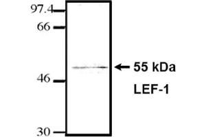 Western Blotting (WB) image for anti-Lymphoid Enhancer-Binding Factor 1 (LEF1) (HMG Binding Domain) antibody (ABIN264380) (LEF1 Antikörper  (HMG Binding Domain))