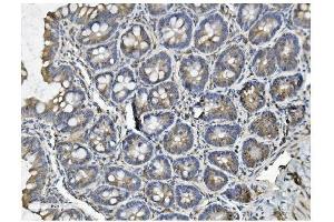 IHC analysis of Clathrin heavy chain/CLTC using anti-Clathrin heavy chain/CLTC antibody (ABIN7602704). (Clathrin Heavy Chain (CLTC) (AA 967-1668) Antikörper)