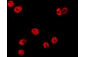 ABIN6277201 staining HepG2 by IF/ICC. (Histone 3 Antikörper  (H3K36me))