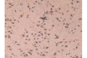 DAB staining on IHC-P; Samples: Mouse Brain Tissue (CCL6 Antikörper  (AA 22-116))