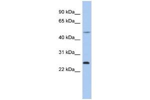WB Suggested Anti-CTRB1 Antibody Titration:  0.