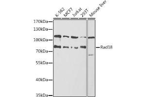 Western blot analysis of extracts of various cell lines, using Rad18 antibody (ABIN6128609, ABIN6146628, ABIN6146630 and ABIN6217430) at 1:1000 dilution. (RAD18 Antikörper  (AA 216-495))
